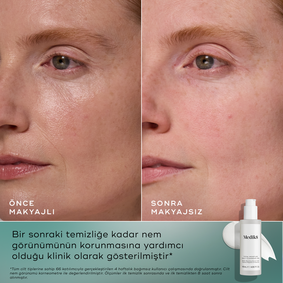 Total Moisture Daily Cleansing Gel-hover-1