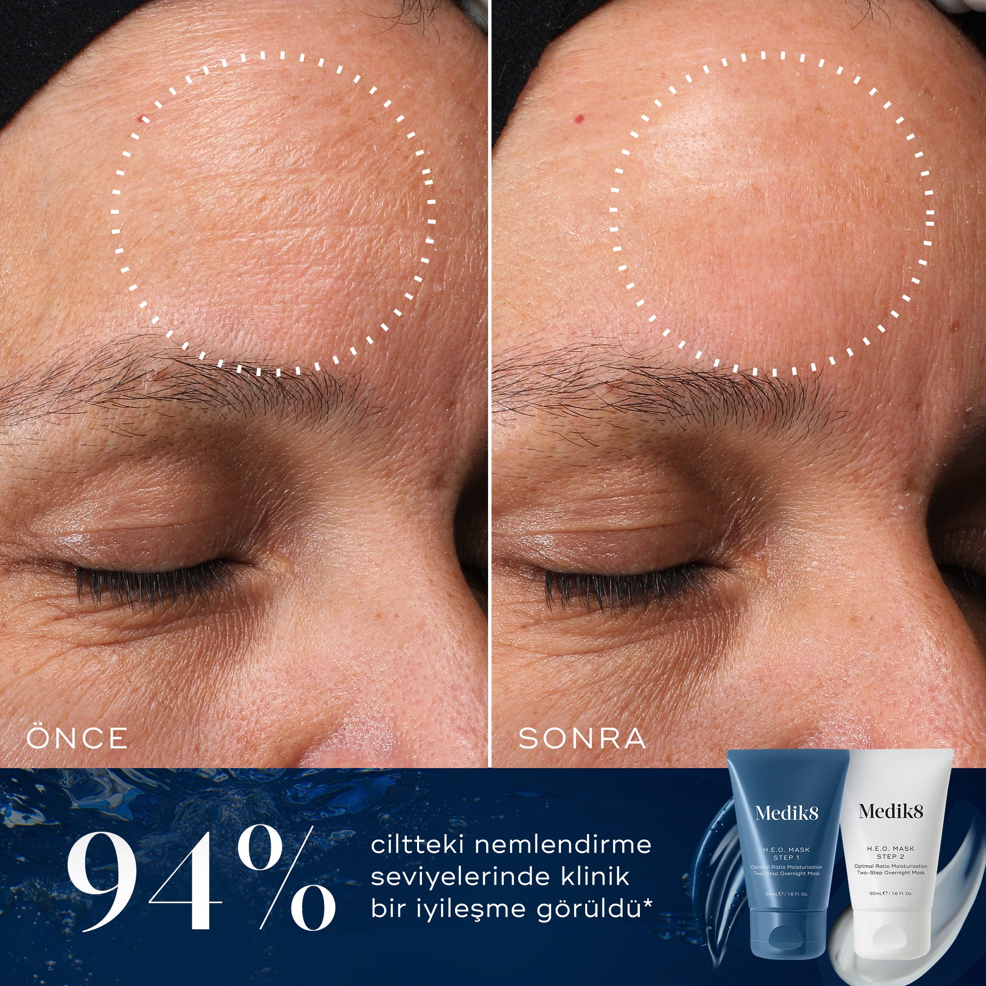 H.E.O.® Mask | Two-step overnight moisturising mask – Medik8